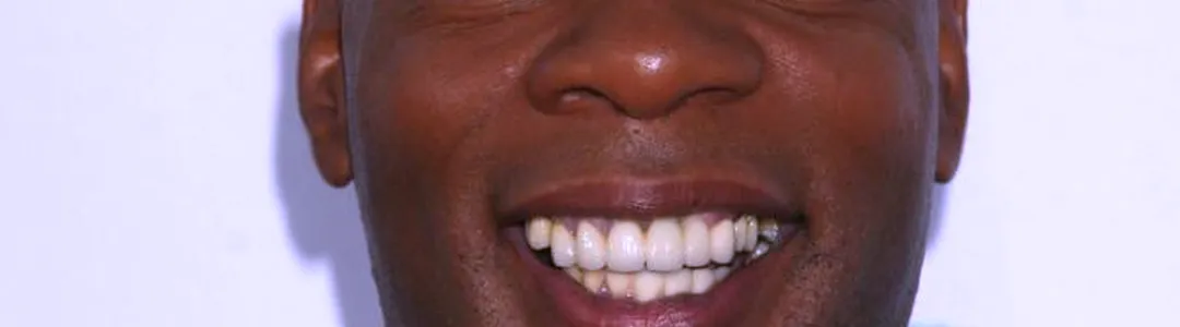 Alonzo Bodden